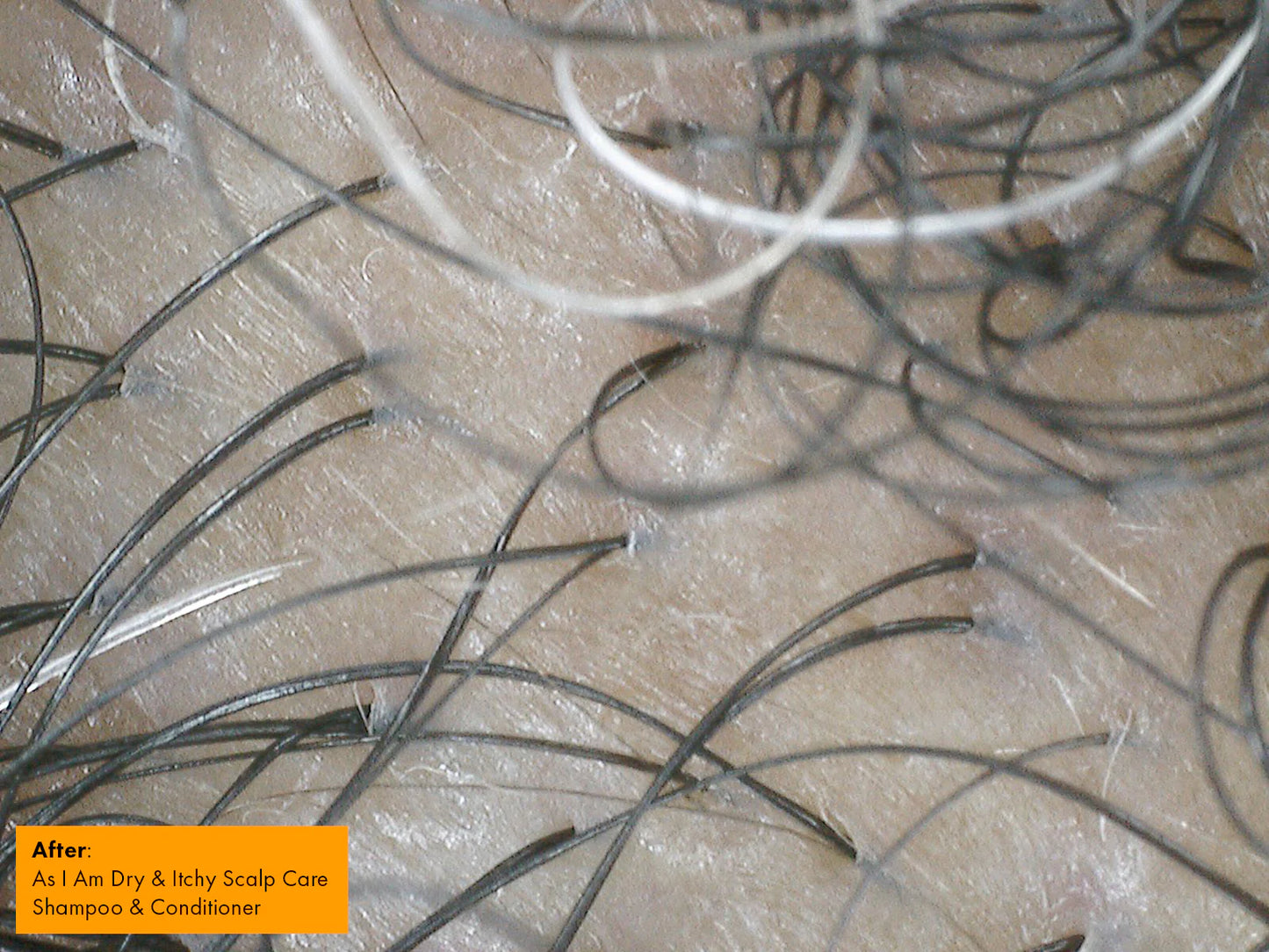 DISC after treatment