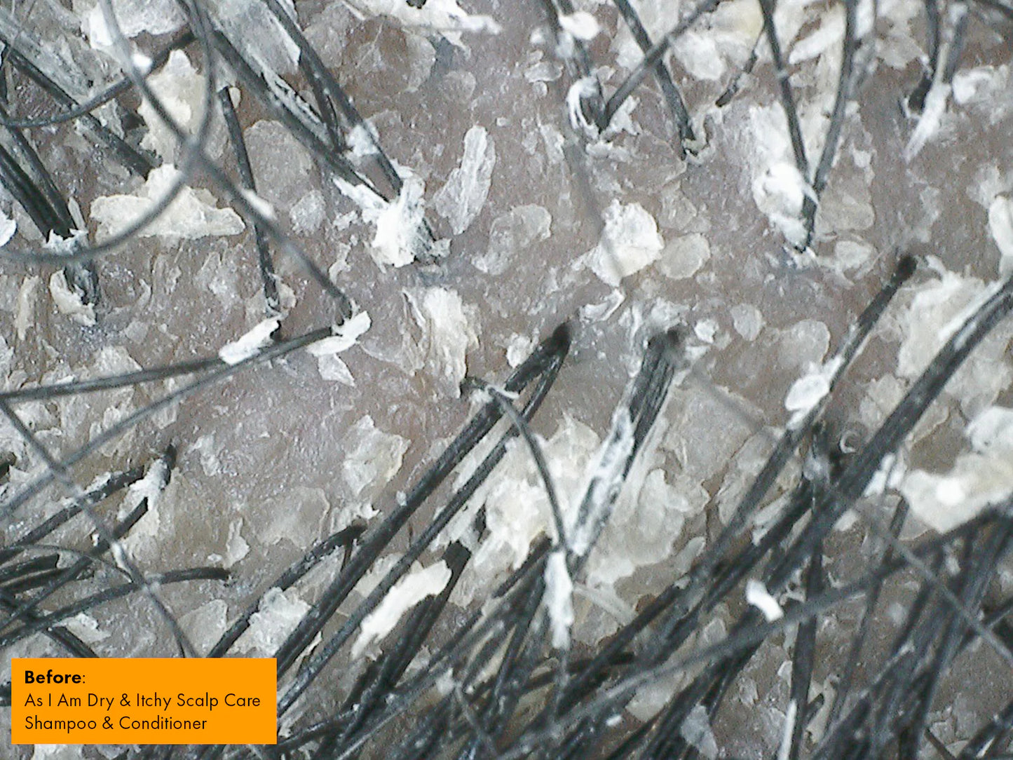 DISC before treatment 